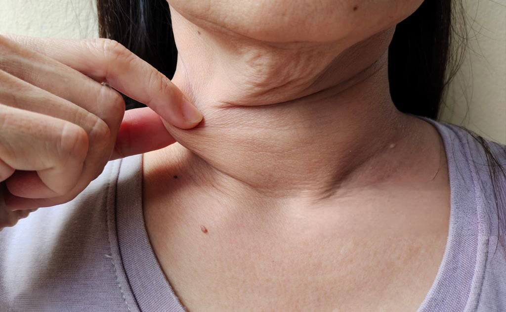 Flacidez facial y corporal